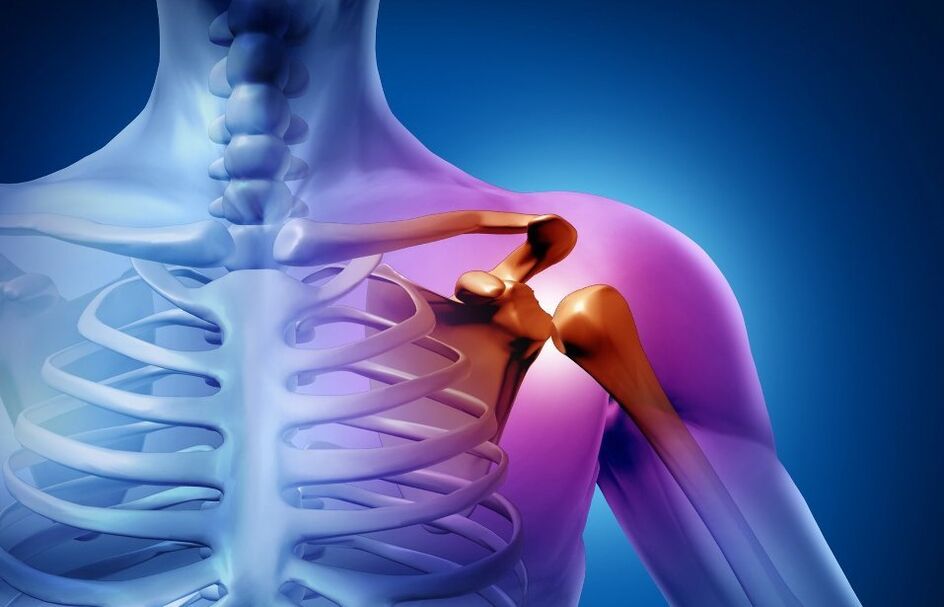 shoulder joint injury due to arthrosis