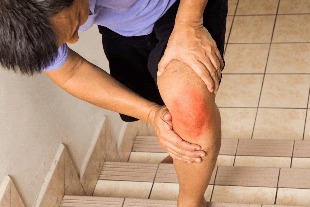 joint pain due to arthrosis