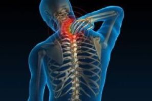 cervical osteochondrosis leads to soreness in the neck